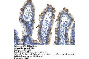 Rabbit Anti-EXOSC3 Antibody  Paraffin Embedded Tissue: Human Intestine Cellular Data: Epithelial cells of intestinal villas Antibody Concentration: 4. (EXOSC3 anticorps  (Middle Region))
