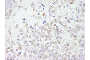 Immunohistochemistry (IHC) image for anti-Cleavage Stimulation Factor, 3' Pre-RNA, Subunit 2, 64kDa (CSTF2) (AA 527-577) antibody (ABIN7448497)