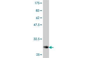 Western Blot detection against Immunogen (31.
