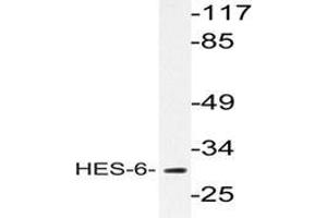 Western blot analysis of HES-6 antibody  in extracts from HeLa cells. (HES6 anticorps)
