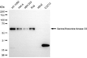 Western blotting analysis using serine/threonine kinase 33 antibody (ABIN7800313). (Recombinant STK33 anticorps)