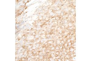 Immunohistochemistry (IHC) image for anti-Y Box Binding Protein 1 (YBX1) (AA 224-274) antibody (ABIN7453588) (YBX1 anticorps  (AA 224-274))