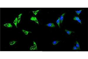 IF analysis of UPF3A using anti-UPF3A antibody (ABIN7601625).