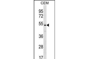 KCNJ4 Antibody (N-term) (ABIN656232 and ABIN2845547) western blot analysis in CEM cell line lysates (35 μg/lane). (KCNJ4 anticorps  (N-Term))