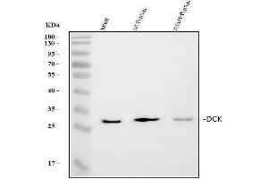 Western blot analysis of DCK using anti-DCK antibody (ABIN5693016). (DCK anticorps  (AA 17-260))