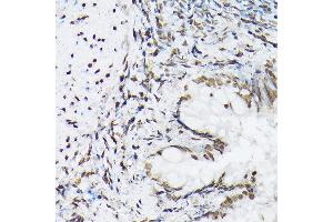 Immunohistochemistry of paraffin-embedded rat lung using Histone H1t Rabbit pAb (ABIN7267716) at dilution of 1:100 (40x lens).