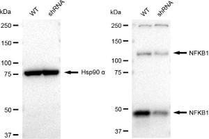 Western blotting analysis using NFKB1 antibody (ABIN7799638).
