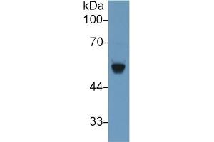 Detection of BACE2 in Rat Serum using Polyclonal Antibody to Beta Secretase 2 (BACE2)
