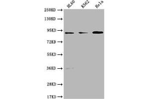 Western Blot Positive WB detected in: HL60 whole cell lysate, K562 whole cell lysate, Hela whole cell lysate All lanes: RPTN antibody at 1:1000 Secondary Goat polyclonal to rabbit IgG at 1/50000 dilution Predicted band size: 91 kDa Observed band size: 91 kDa (Repetin anticorps  (AA 86-103))