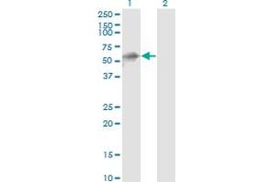 Western Blot analysis of KBTBD10 expression in transfected 293T cell line by KBTBD10 monoclonal antibody (M01), clone 1H3. (Kelch-like protein 41 (KLHL41) (AA 205-304) anticorps)
