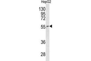 Western Blotting (WB) image for anti-Nucleoporin 62kDa (NUP62) antibody (ABIN3003247) (NUP62 anticorps)
