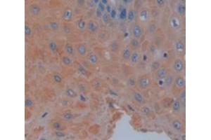 IHC-P analysis of Human Tissue, with DAB staining. (TRAF6 anticorps  (AA 153-423))