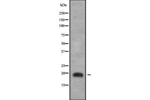 Western blot analysis of JDP2 using COLO205 whole cell lysates (JDP2 anticorps  (C-Term))