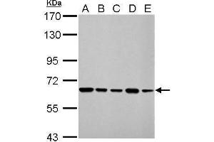 WB Image AIF antibody [N1N2], N-term detects AIFM1 protein by Western blot analysis.