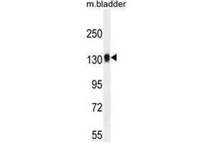 TDRD7 Antibody (C-term) western blot analysis in mouse bladder tissue lysates (35 µg/lane). (TDRD7 anticorps  (C-Term))