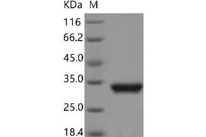 Western Blotting (WB) image for Green Fluorescent Protein (GFP) protein (His tag) (ABIN7320941)