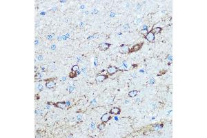 Immunohistochemistry of paraffin-embedded rat brain using NMD Rabbit pAb (ABIN6133733, ABIN6141400, ABIN6141403 and ABIN6223602) at dilution of 100 (40x lens). (GRIN1/NMDAR1 anticorps  (AA 600-700))