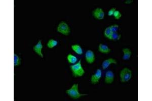 Immunofluorescent analysis of MCF-7 cells using ABIN7170144 at dilution of 1:100 and Alexa Fluor 488-congugated AffiniPure Goat Anti-Rabbit IgG(H+L) (SLC22A2 anticorps  (AA 48-135))