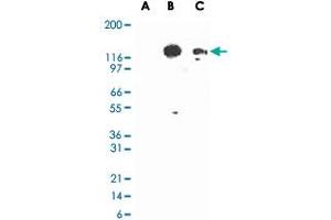 Western blot analysis of TLR3 in lysates from untransfected 293 cells (lane A), 293 cells transfected with human TLR3 cDNA (lane B), and 20 ug/lane human intestine tissue lysate (lane C). (TLR3 anticorps)
