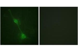 Immunofluorescence analysis of NIH-3T3 cells, using Ataxin 1 (Ab-776) Antibody.