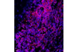 Immunofluorescence of paraffin embedded human lymph node using Thymosin (ABIN7075306) at dilution of 1:1500 (400x lens) (PTMA anticorps)