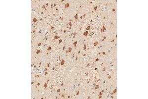 Immunohistochemical analysis of paraffin-embedded human brain tissue using (ABIN1881847 and ABIN2838812) performed on the Leica® BOND RXm.