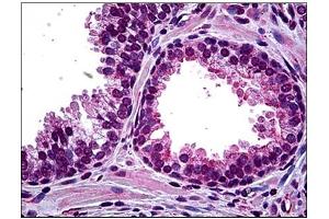 Immunohistochemistry (IHC) image for anti-Homeodomain Interacting Protein Kinase 2 (HIPK2) antibody (ABIN781914) (HIPK2 anticorps)