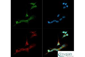 Image no. 3 for anti-Cytochrome P450, Family 19, Subfamily A, Polypeptide 1 (CYP19A1) (C-Term) antibody (ABIN363492) (Aromatase anticorps  (C-Term))