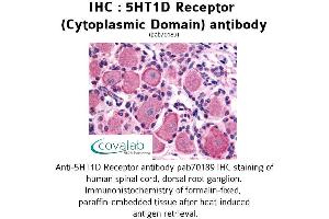 Image no. 1 for anti-Serotonin Receptor 1D (HTR1D) (3rd Cytoplasmic Domain) antibody (ABIN1731350) (5HT1D anticorps  (3rd Cytoplasmic Domain))