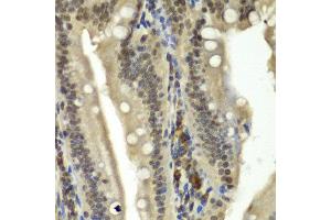 Immunohistochemistry of paraffin-embedded rat Intestine using RBBP5 antibody at dilution of 1:100 (x40 lens). (RBBP5 anticorps)