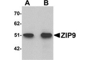 Western blot analysis of ZIP9 in HepG2 cell lysate with ZIP9 antibody at (A) 1 and (B) 2 μg/ml. (SLC39A9 anticorps  (N-Term))