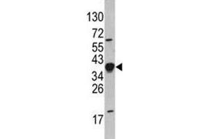 Western blot analysis of NANOG antibody and HepG2 lysate.