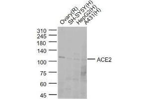 Lane 1: Rat Ovary lysates; Lane 2:SH-SY5Y cell lysates; Lane 3:HepG2 cell lysates; Lane 4: A431 cell lysates probed with ACE2 Polyclonal Antibody, Unconjugated (bs-23027R) at 1:1000 dilution and 4˚C overnight incubation. (ACE2 anticorps  (AA 251-350))