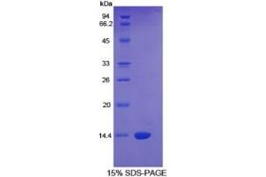 SDS-PAGE of Protein Standard from the Kit  (Highly purified E.