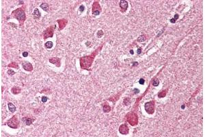Human Brain, Cortex (formalin-fixed, paraffin-embedded) stained with KIAA1303 antibody ABIN214505 at 2. (Raptor anticorps)