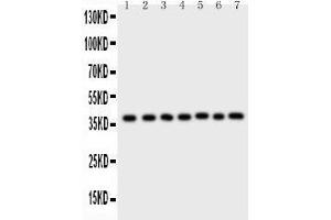 Western Blotting (WB) image for anti-Aryl Hydrocarbon Receptor Interacting Protein (AIP) (AA 91-330) antibody (ABIN3043728) (AIP anticorps  (AA 91-330))