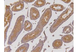 IHC analysis of EHD1 using anti-EHD1 antibody (ABIN6719599). (EHD1 anticorps  (AA 324-516))