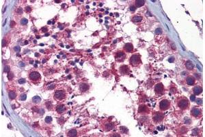 Human Testis: Formalin-Fixed, Paraffin-Embedded (FFPE)