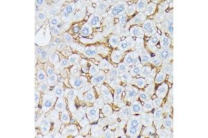 Immunohistochemistry of paraffin-embedded mouse liver using CTNN antibody (ABIN7266134) at dilution of 1:100 (40x lens).
