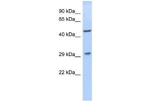 LIX1 antibody used at 1 ug/ml to detect target protein. (LIX1 anticorps)