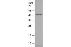 Western Blotting (WB) image for Surfactant Protein A1 (SFTPA1) (AA 42-248) protein (His-IF2DI Tag) (ABIN7125259)