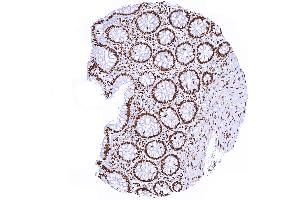 Colon mucosa with distinct nuclear Histone H3 staining