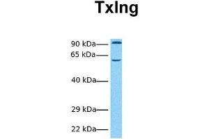Host:  Rabbit  Target Name:  Txlng  Sample Tissue:  Human Fetal Heart  Antibody Dilution:  1. (Taxilin gamma (TXLNG) (N-Term) anticorps)