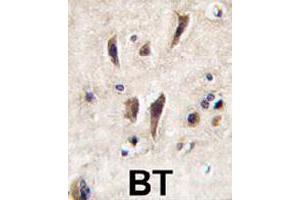 Formalin-fixed and paraffin-embedded human brain tissue reacted with TIE1 polyclonal antibody  , which was peroxidase-conjugated to the secondary antibody, followed by DAB staining.