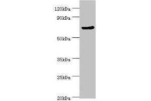 Western blot All lanes: CDC16 antibody at 4 μg/mL + Jurkat whole cell lysate Secondary Goat polyclonal to rabbit IgG at 1/10000 dilution Predicted band size: 72, 66, 61 kDa Observed band size: 72 kDa