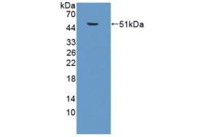 Western blot analysis of recombinant Mouse SPC. (Surfactant Protein C anticorps  (AA 1-193))