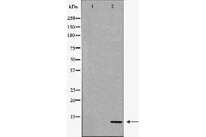 Western blot analysis of extracts of HeLa , using S100A4antibody. (s100a4 anticorps  (C-Term))