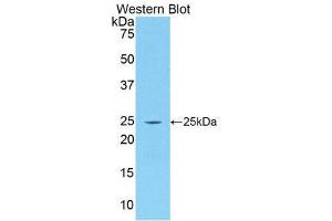 Western Blotting (WB) image for anti-Procollagen III N-Terminal Propeptide (PIIINP) (AA 24-153) antibody (ABIN1173222) (PIIINP anticorps  (AA 24-153))