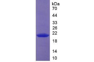 SDS-PAGE analysis of Human Collagen Type XVIII Protein. (COL18 Protéine)