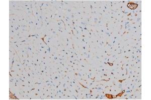 ABIN6267438 at 1/200 staining Mouse heart tissue sections by IHC-P.